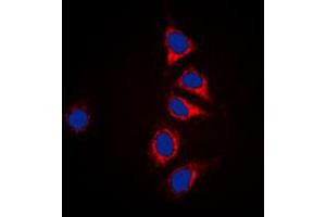 Immunofluorescent analysis of DUSP6 staining in HepG2 cells. (DUSP6 antibody  (Center))
