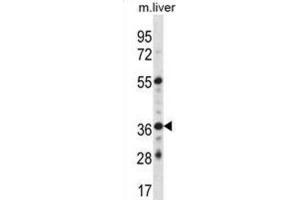 Western Blotting (WB) image for anti-G Protein-Coupled Estrogen Receptor 1 (GPER) antibody (ABIN2998385) (GPER antibody)