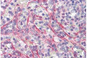 Human Spleen (formalin-fixed, paraffin-embedded) stained with SLC29A1 antibody ABIN462073 followed by biotinylated goat anti-rabbit IgG secondary antibody ABIN481713, alkaline phosphatase-streptavidin and chromogen.