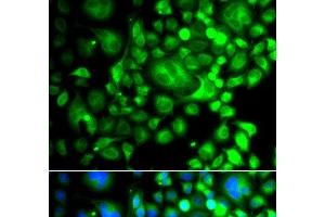 Immunofluorescence analysis of A549 cells using SNX3 Polyclonal Antibody (Sorting Nexin 3 antibody)