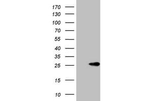 Western Blotting (WB) image for anti-ATP-Binding Cassette, Sub-Family C (CFTR/MRP), Member 5 (ABCC5) antibody (ABIN2715617)