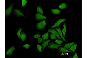 Immunofluorescence of monoclonal antibody to BUB1B on HeLa cell. (BUB1B antibody  (AA 1-130))