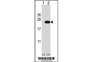 Western blot analysis of CIRBP using rabbit polyclonal CIRBP Antibody using 293 cell lysates (2 ug/lane) either nontransfected (Lane 1) or transiently transfected (Lane 2) with the CIRBP gene. (CIRBP antibody  (C-Term))