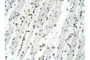 TRIM32 antibody was used for immunohistochemistry at a concentration of 4-8 ug/ml to stain Skeletal muscle cells (arrows) in Human Muscle. (TRIM32 antibody  (C-Term))