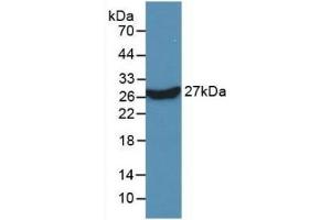 Detection of Recombinant KPNa2, Human using Monoclonal Antibody to Karyopherin Alpha 2 (KPNa2) (KPNA2 antibody  (AA 157-412))