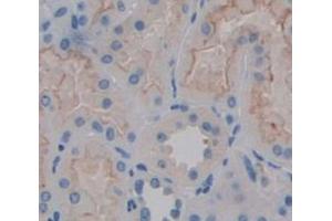 IHC-P analysis of Human Tissue, with DAB staining. (CAPNL1 antibody  (AA 75-343))