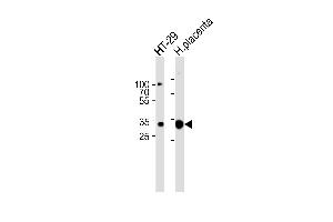 Western blot analysis of lysates from HT-29 cell line and human placenta tissue lysate(from left to right),using GJB7 Antibody (ABIN6241921).