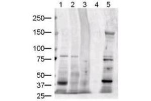 Image no. 3 for anti-Jagged 1 (JAG1) (AA 110-125) antibody (ABIN401024) (JAG1 antibody  (AA 110-125))