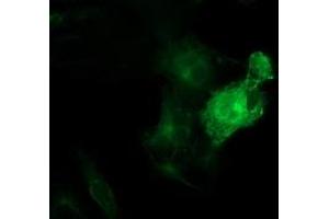 Anti-TUBB4 mouse monoclonal antibody (ABIN2454747) immunofluorescent staining of COS7 cells transiently transfected by pCMV6-ENTRY TUBB4 (RC203945). (TUBB4 antibody)