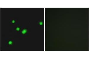 Immunofluorescence analysis of A549 cells, using MUTYH Antibody. (MUTYH antibody  (AA 151-200))