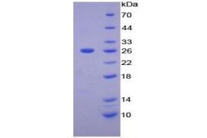 SDS-PAGE of Protein Standard from the Kit (Highly purified E. (MMP11 ELISA Kit)