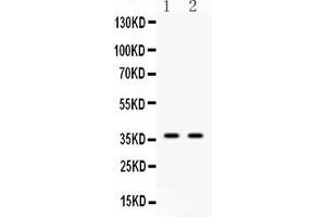 Western blot analysis of Annexin VIII using anti-Annexin VIII antibody .