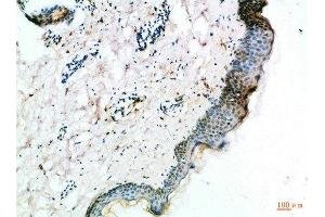 Immunohistochemical analysis of paraffin-embedded Human-skin, antibody was diluted at 1:100 (FZD4 antibody  (AA 11-60))