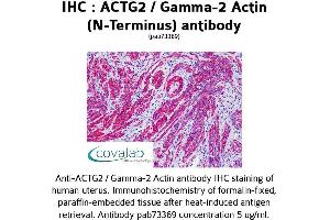 Image no. 1 for anti-Actin, gamma 2, Smooth Muscle, Enteric (ACTG2) antibody (ABIN1731474) (ACTG2 antibody)