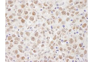anti-Chromosome 7 Open Reading Frame 27 (C7orf27) (C-Term) antibody