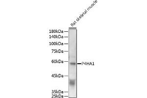 Western blot analysis of extracts of Rat skeletal muscle, using P4H antibody (0538) at 1:500 dilution. (P4HA1 antibody  (AA 235-534))