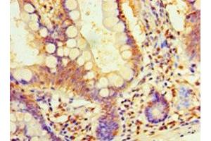 Immunohistochemistry of paraffin-embedded human small intestine tissue using ABIN7164411 at dilution of 1:100 (DIMT1 antibody  (AA 1-313))