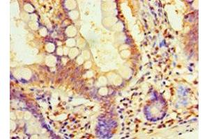 Immunohistochemistry of paraffin-embedded human small intestine tissue using ABIN7164411 at dilution of 1:100