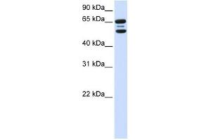 FBXO21 antibody used at 1 ug/ml to detect target protein.