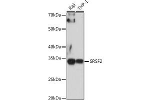 Western blot analysis of extracts of various cell lines, using SRSF2 antibody (ABIN1682677, ABIN3017915, ABIN3017916, ABIN5664377 and ABIN6220303) at 1:1000 dilution.