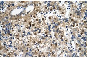 Immunohistochemistry (IHC) image for anti-Squalene Epoxidase (SQLE) (C-Term) antibody (ABIN2777142)