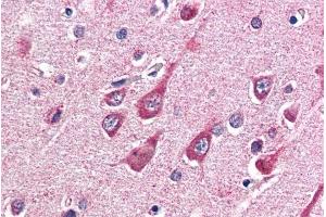 ABIN190863 (5µg/ml) staining of paraffin embedded Human Cortex. (OGT antibody  (Internal Region))