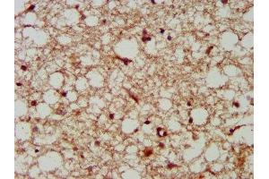 IHC image of ABIN7157906 diluted at 1:300 and staining in paraffin-embedded human brain tissue performed on a Leica BondTM system. (LANCL2 antibody  (AA 2-106))