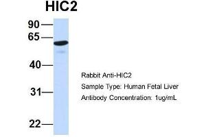 Host:  Rabbit  Target Name:  HIC2  Sample Type:  Human Fetal Liver  Antibody Dilution:  1. (HIC2 antibody  (Middle Region))