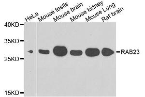 Western blot analysis of extracts of various cell lines, using RAB23 antibody.