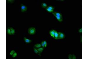 Immunofluorescence staining of HepG2 cells with ABIN7150786 at 1:200, counter-stained with DAPI. (DUSP9 antibody  (AA 142-263))