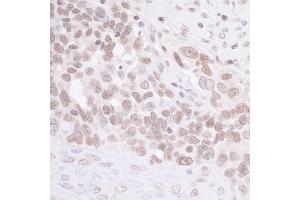 Immunohistochemistry (IHC) image for anti-MIS12, MIND Kinetochore Complex Component, Homolog (MIS12) (C-Term) antibody (ABIN7453483) (MIS12 antibody  (C-Term))