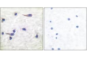 Immunohistochemistry analysis of paraffin-embedded human brain, using Tau (Phospho-Thr212) Antibody. (tau antibody  (pThr529))