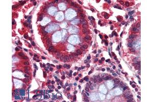 ABIN185388 (2. (GAD65 antibody  (Internal Region))