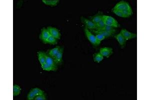 Immunofluorescent analysis of HepG2 cells using ABIN7144986 at dilution of 1:100 and Alexa Fluor 488-congugated AffiniPure Goat Anti-Rabbit IgG(H+L) (DDX3X antibody  (AA 2-662))