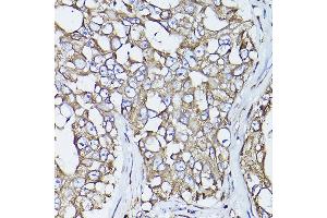 Immunohistochemistry (IHC) image for anti-Prolyl 4-Hydroxylase, beta Polypeptide (P4HB) antibody (ABIN6134876)