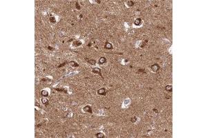 Immunohistochemical staining of human hippocampus with GOLGA3 polyclonal antibody  shows strong cytoplasmic positivity in neuronal cells at 1:500-1:1000 dilution.