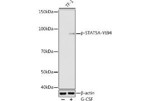 Western blot analysis of extracts of TF-1 cells, using Phospho-STA-Y694 antibody (ABIN3019613, ABIN3019614, ABIN3019615 and ABIN6225491) at 1:1000 dilution. (STAT5A antibody  (pTyr694))