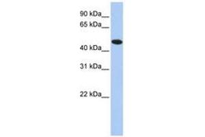 Image no. 1 for anti-Thioredoxin Domain Containing 5 (Endoplasmic Reticulum) (TXNDC5) (AA 36-85) antibody (ABIN6741464) (TXNDC5 antibody  (AA 36-85))
