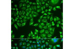 Immunofluorescence analysis of U2OS cells using PNLIP Polyclonal Antibody (PNLIP antibody)