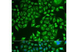 Immunofluorescence analysis of U2OS cells using PNLIP Polyclonal Antibody (PNLIP antibody)