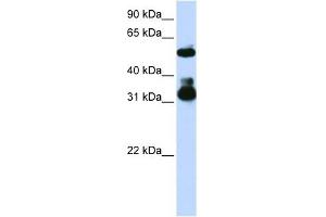 FBXW2 antibody used at 1 ug/ml to detect target protein. (FBXW2 antibody  (Middle Region))