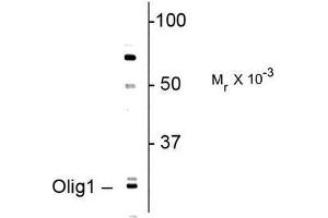 Image no. 1 for anti-Oligodendrocyte Transcription Factor 1 (OLIG1) antibody (ABIN372692)