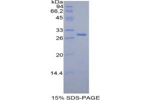 SDS-PAGE analysis of Rat FDFT1 Protein. (FDFT1 Protein)