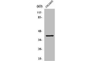 Western Blot analysis of COLO205 cells using ABHD6 Polyclonal Antibody (ABHD6 antibody  (Internal Region))