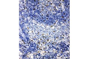 Anti-IRAK2 antibody, IHC(P) IHC(P): Rat Spleen Tissue (IRAK2 antibody  (C-Term))