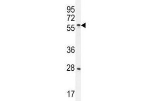DLK antibody western blot analysis in CEM lysate. (MAP3K12 antibody)