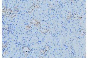 ABIN6279543 at 1/100 staining Mouse kidney tissue by IHC-P. (TAM41 antibody  (Internal Region))