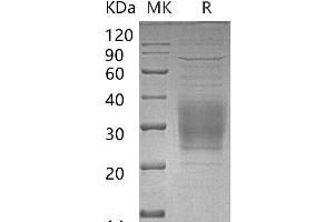 Triggering Receptor Expressed On Myeloid Cells 2 (TREM2) protein (His tag)