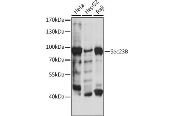 Sec23 Homolog B 抗体  (AA 150-250)