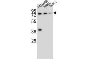 UGT2B15 Antibody (Center) western blot analysis in NCI-H460,HepG2,ZR-75-1 cell line lysates (35 µg/lane). (UGT2B15 antibody  (Middle Region))